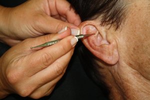 Ohrreflexzonen Therapie